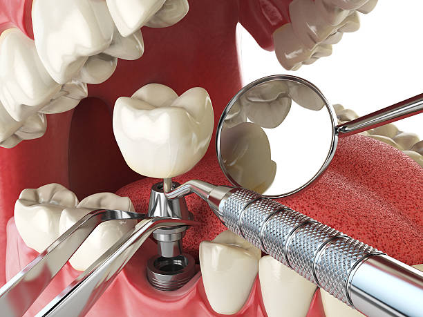 Best Broken or Cracked Tooth Emergency Dentist in Lawnside, NJ